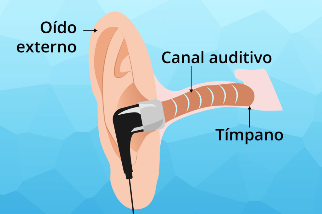 placement_diagram